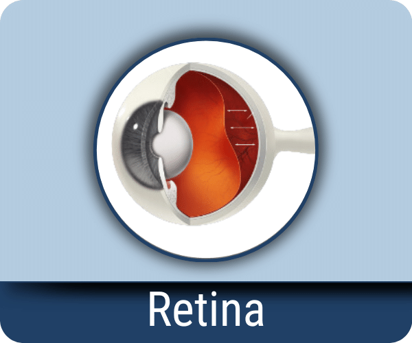 Retina
