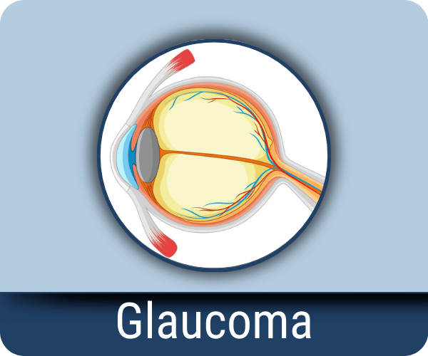 Glaucoma