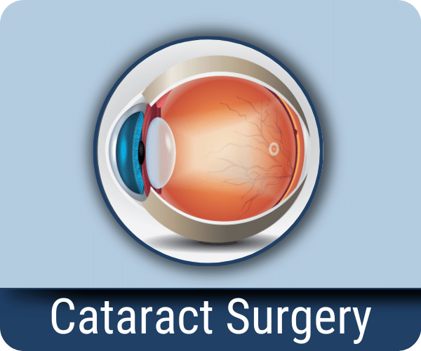 Cataract Surgery
